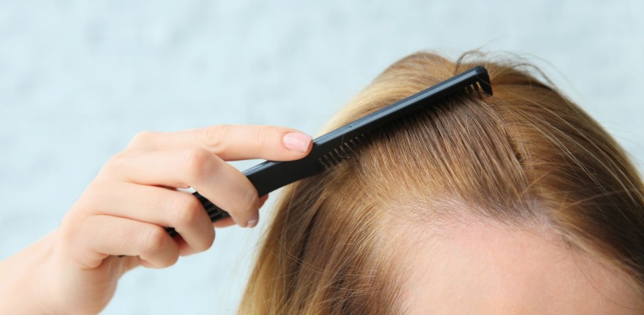 Caída del cabello, soluciones eficaces para prevenirla